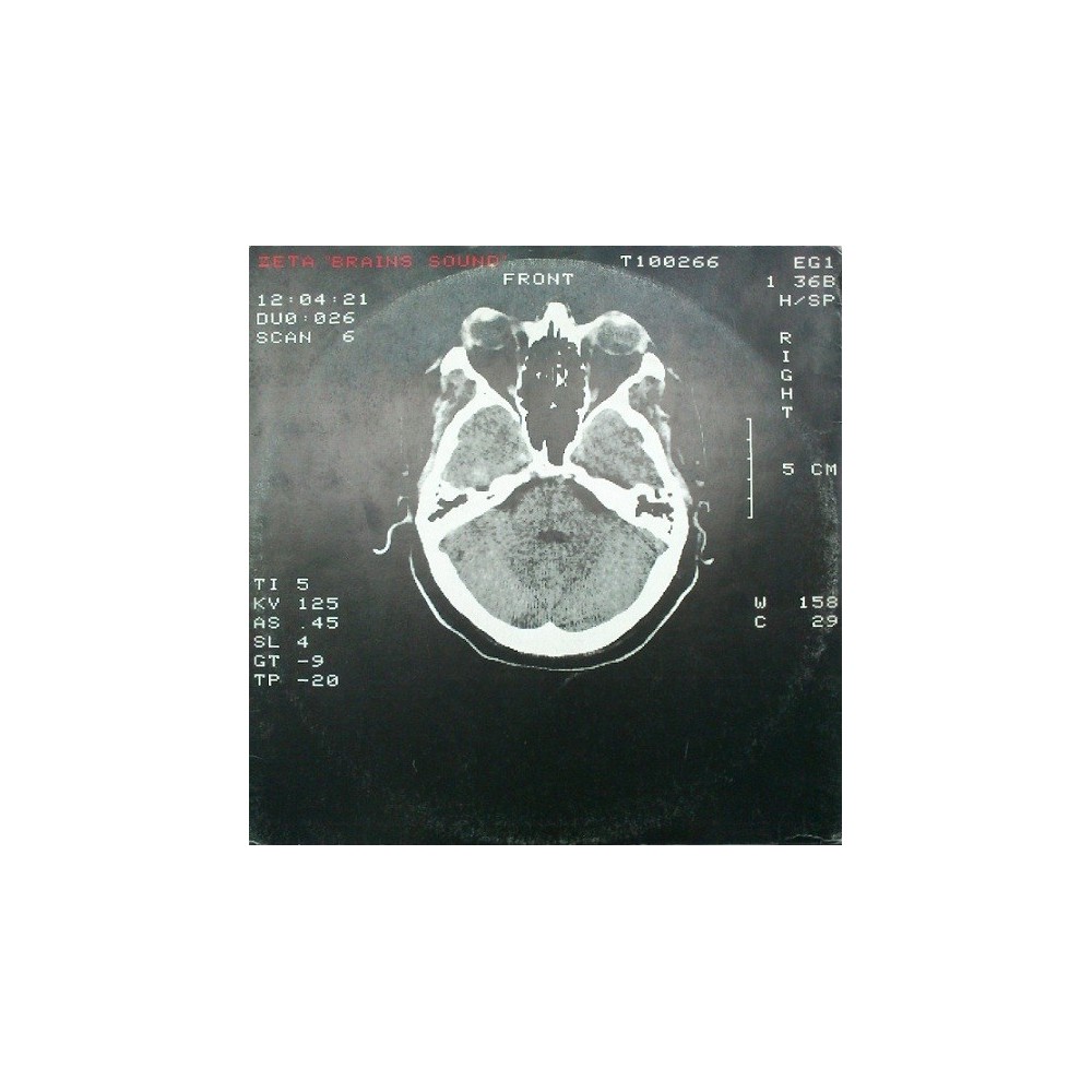 Zeta ‎– Brains Sound 